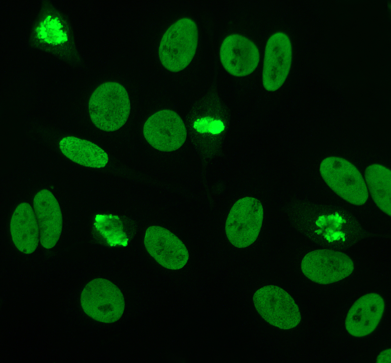 Antinuclear Antibody Test Market to Reach $5.0 Bn, Globally, by 2031 at 15.0% CAGR: Allied Market Research