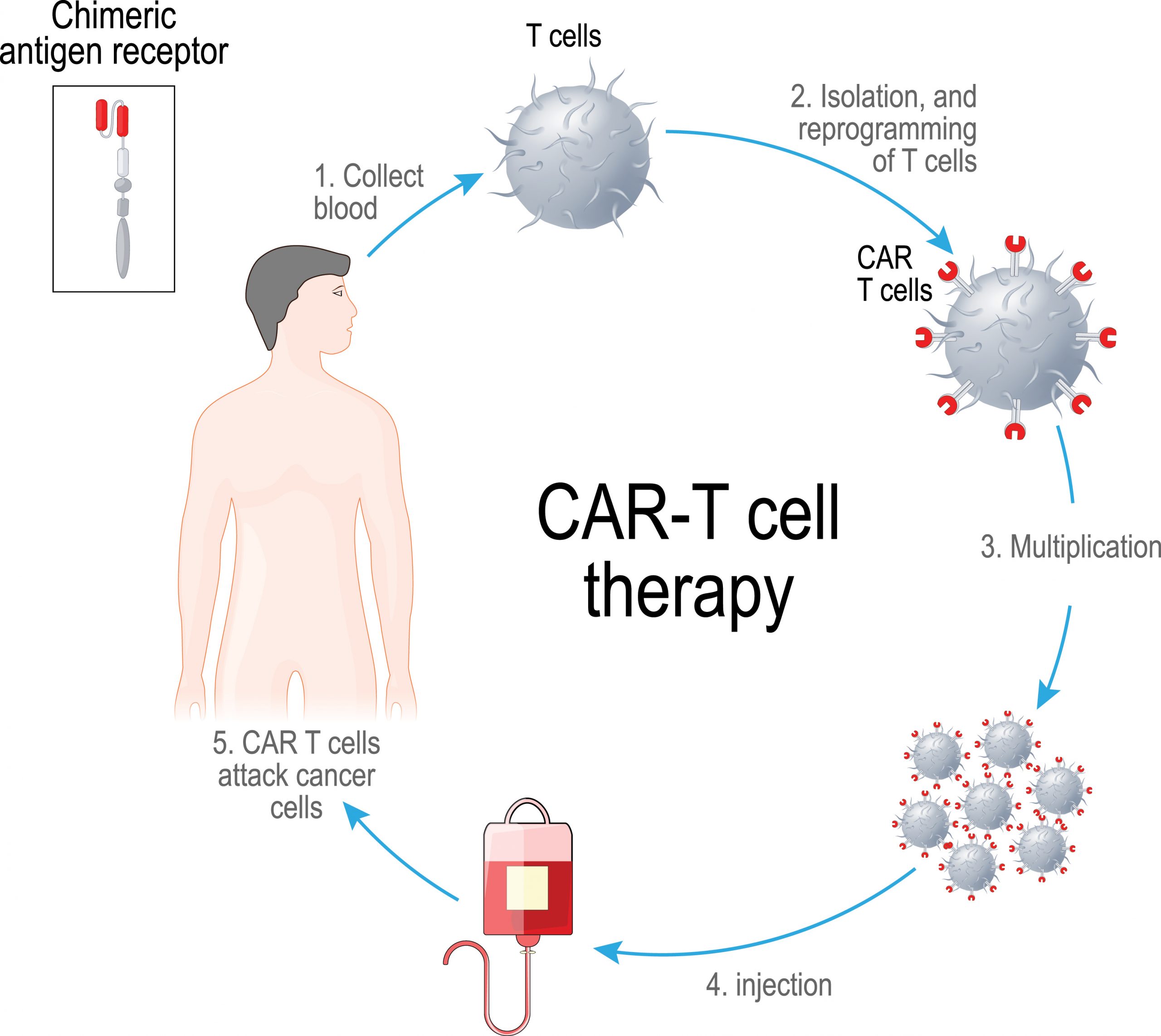 CAR T-Cell Therapy Market Predicted to Reach USD 6.1 Billion by 2030 at 13.5% CAGR Allied Market Research