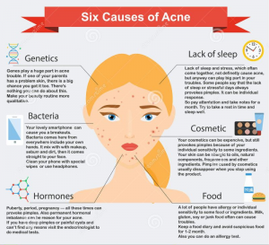 Acne Medication Market