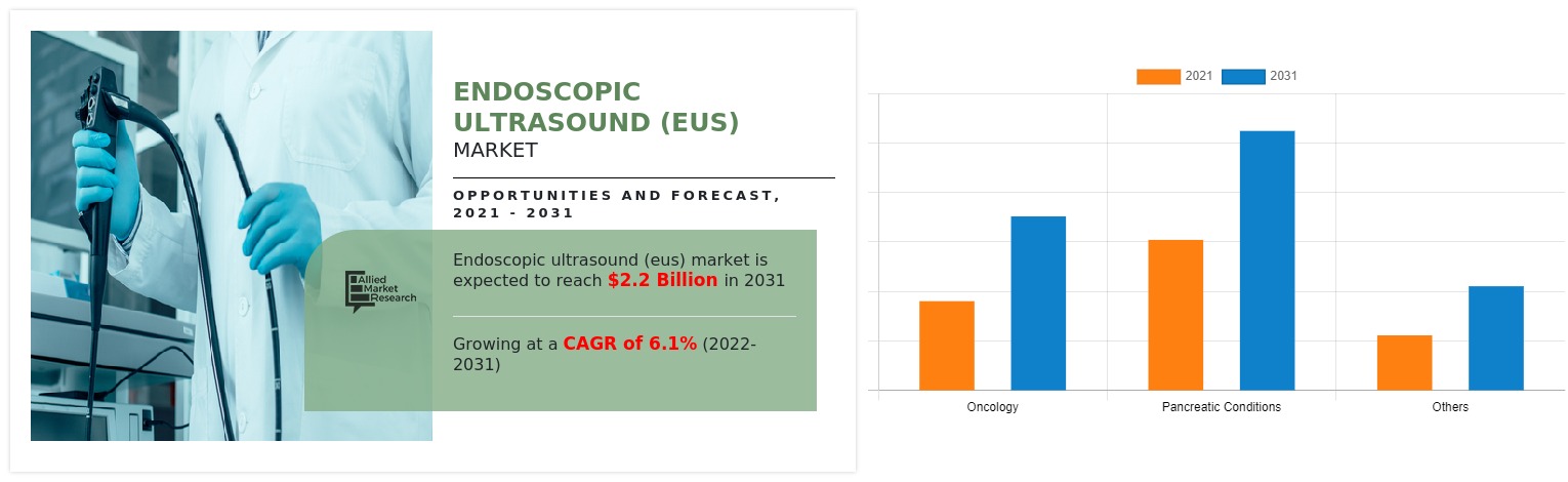 Endoscopic Ultrasound (EUS): Understanding the Market Landscape and Identifying Key Players