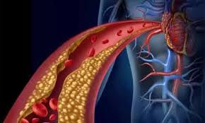 Familial Hypercholesterolemia Treatment Market : Recent Innovations, Applications and Growth Analysis Till 2030 | Global Health Care Industry