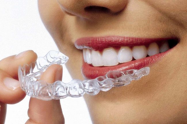 Invisible Orthodontics: A Revolutionary Advancement in Teeth Straightening Technology